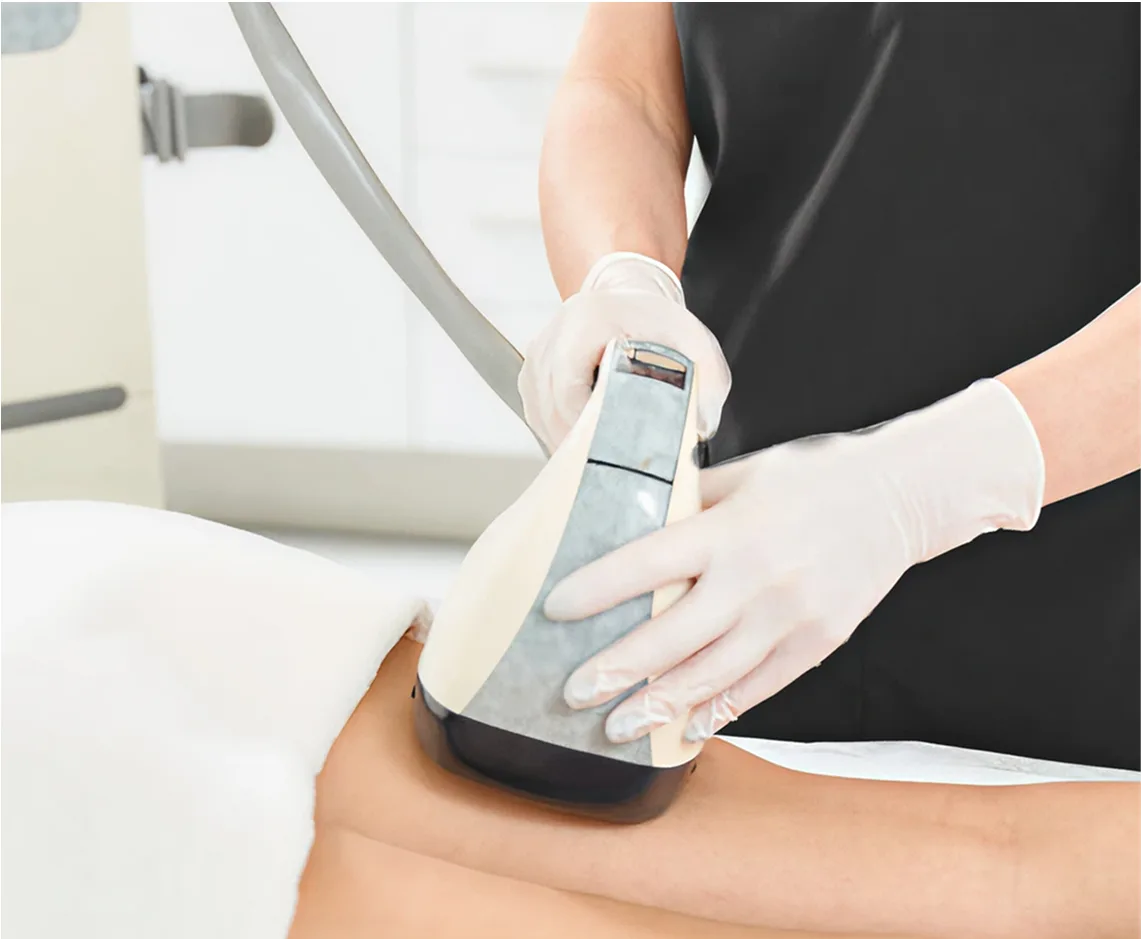 VelaShape III on the thigh