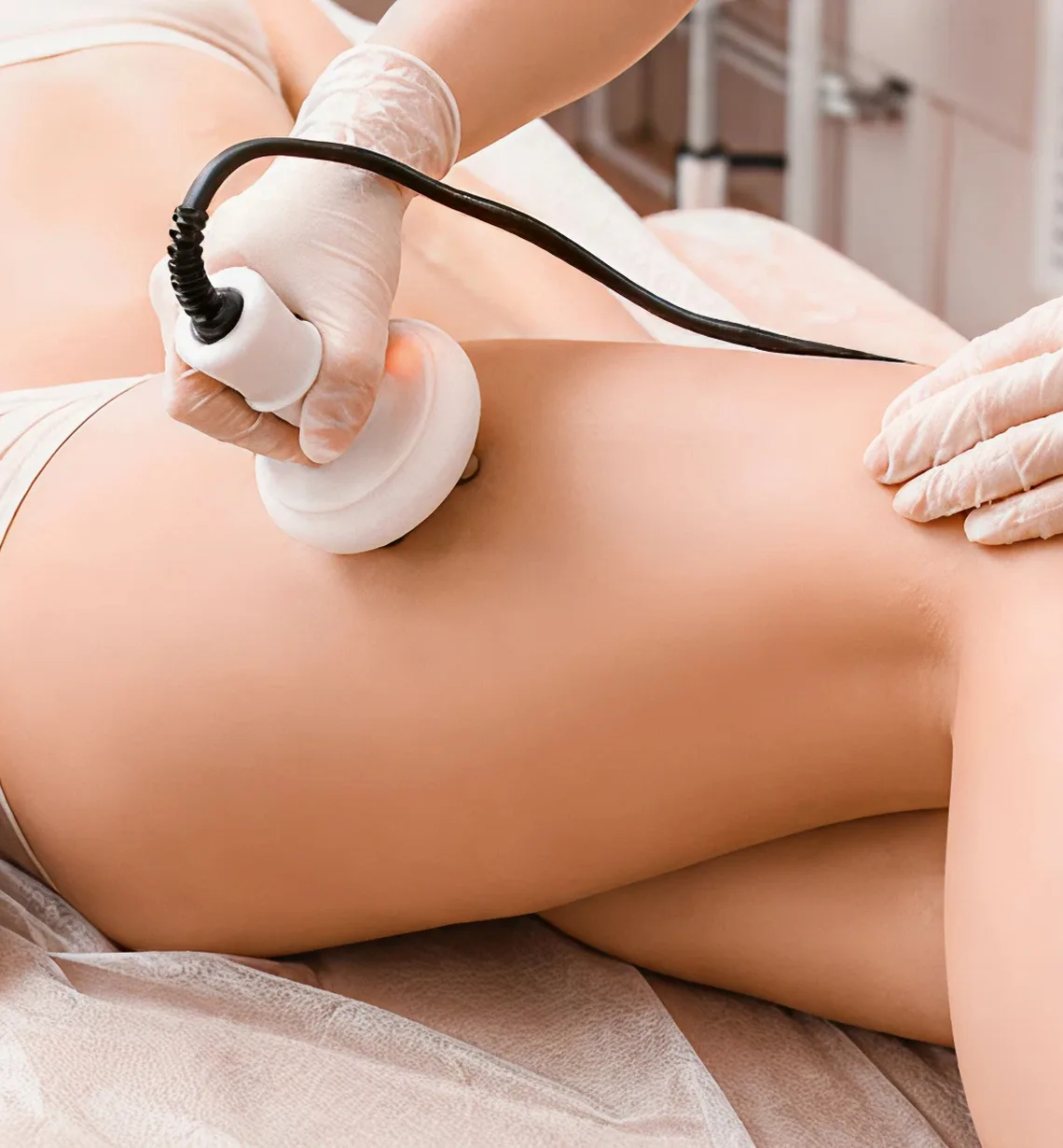 Venus Legacy applicator on the thigh